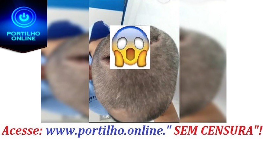 👉😱😮💉😮😭🤤😪Cenas fortes: homem é intubado com Covid e acorda com cabeça rachada