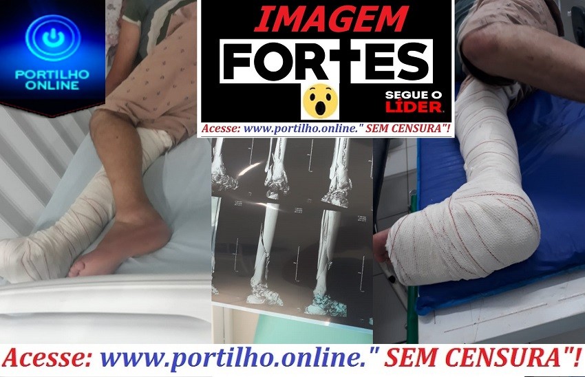 👉😪😔😳🚑🚒😔Boa noite Portilho, Gostaria de saber si tem como vc mi ajuda postando… Portilho, ossos da minha perna foram esmagados.  Sou serralheiro autônomo e sofri um acidente tralhando.