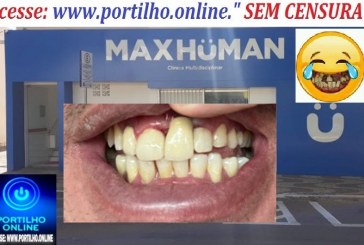 👉😠😡😱😳😂🙄🧐🤓👁Clínica Odontológica  Max Human “Uma imagem vale mais que mil palavras”!!!