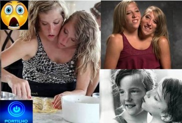 👉Olha que linda história de compartilhamento em só corpo com duas cabeças femininas😱🧦📢🧐😮🤔👏😍A história de Abby e Brittany Hensel, as famosas gêmeas conjugadas
