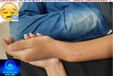 👉📢👹😱🔍🧐🤡💰💸👎👁🤡 Mãe denuncia que erro médico encurtou braço de menino com deficiência