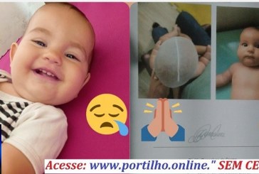 👉📢👏🙏😪😔🧠👩🚑💊🕳🌡Mãe desesperada pede ajuda para a Ana Isabelle Marques Silva, 11 meses de idade sofre Plagiocefalia