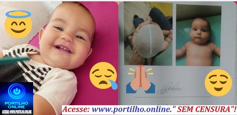 👉”Essa mãe procurou todas as formas 📢👏🙏😪😔🧠👩🚑💊🕳🌡Mãe desesperada pede ajuda para a Ana Isabelle Marques Silva, 11 meses de idade sofre Plagiocefalia