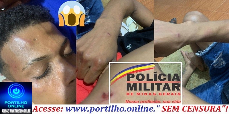 👉📢🚨👀🗣⚖🔎🕵🔍👁🤔🚒🚑🚔🚓Denúncia de agressão policial: mãe relata ataque a filho em pronto-socorro