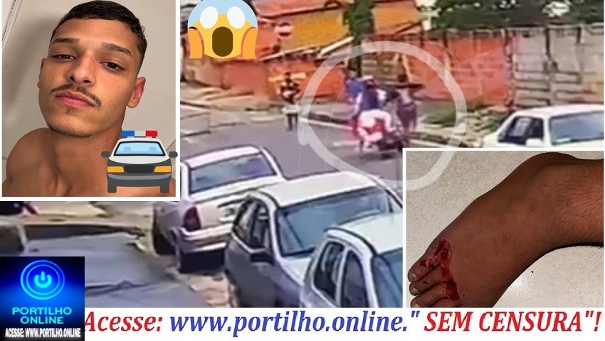 👉🚑😱 Vídeo 🚓🚧🚨🫵👣😡👎👏Tocador de moto passa em cima do pé de jovem de propósito