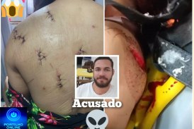 👉🏻🗡🔪🚔🚒🚑😱🚨Essa mulher foi golpeada com 🔪🗡facadas nas costas e sofreu tentativa de degola em um caso de tentativa de feminicídio.🗡 🔪.