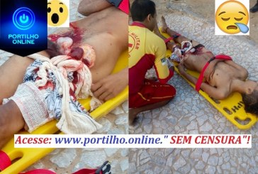 Jovem é atacado por tubarão em Jaboatão dos Guararapes
