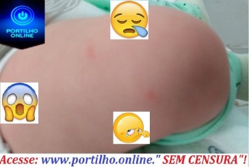 Portilho, meu bebê está todo picado de pernilongos “40 graus de febre”!