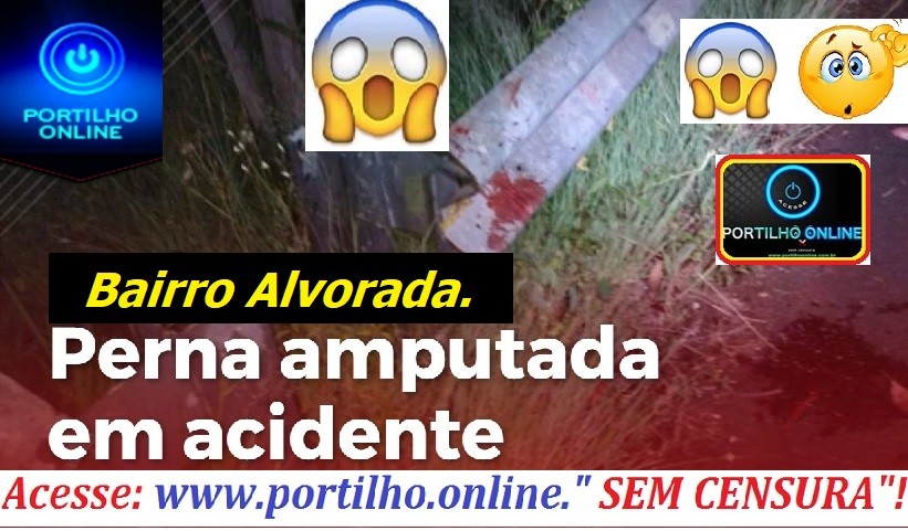 👉👉🚨😱😱ACIDENTE FEIO!!! Motociclista teve uma das pernas arrancada!!!