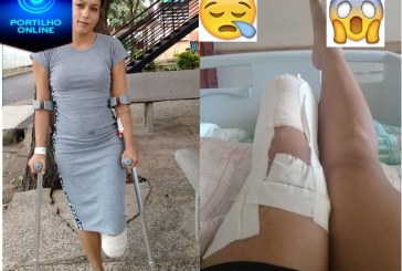 CIRURGIA Amputacao Transtibia! Thaís Fátima Teixeira Silva, em fim foi operada!