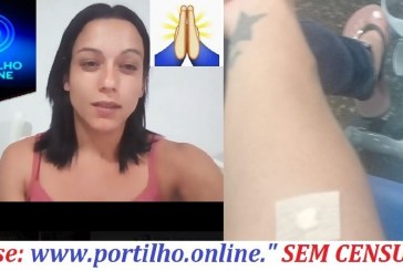 👉😱👏🙌CIRURGIA DE AMPUTAÇÃO!!! Thaís de Fátima Teixeira Silva terá uma perna amputada!