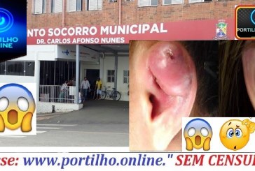 👉🤒🌡💉🤧🌡💊 Piercing infeccionado ! PRONTO SOCORRO! Boa tarde Portilho acho que não só eu, mas toda a população precisa da sua ajuda.