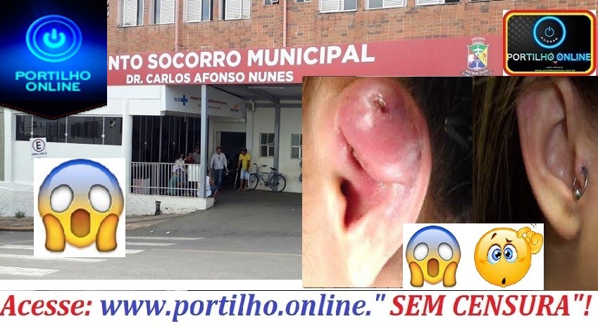 👉🤒🌡💉🤧🌡💊 Piercing infeccionado ! PRONTO SOCORRO! Boa tarde Portilho acho que não só eu, mas toda a população precisa da sua ajuda.