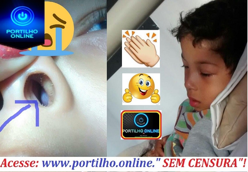   👉🚨🚑👏👍😀👍 Olá.. boa  tarde Portilho… Queria te falar q graças a Deus meu filho fez a cirurgi