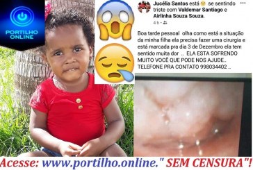 👉😔😱🤔😰😭😪😥Pedido de ajuda para uma criancinha. A mãe e o pai não tem condição.