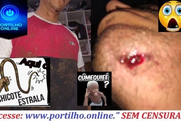 👉😡👎👊🚨🚓⚖😱🚑ABUSO DE “AUTORIDADE POLICIAL” Policial Militar SD-Carlos agride jovem em Serra do Salitre.