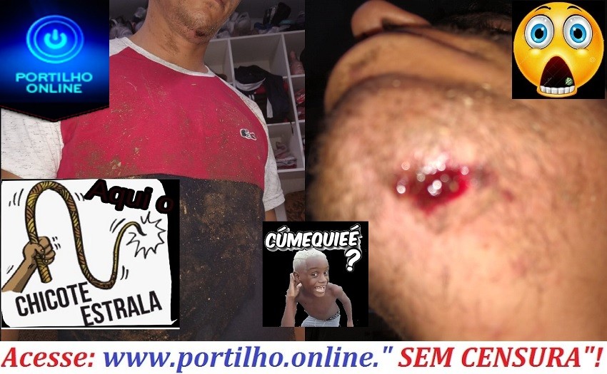 👉😡👎👊🚨🚓⚖😱🚑ABUSO DE “AUTORIDADE POLICIAL” Policial Militar SD-Carlos agride jovem em Serra do Salitre.