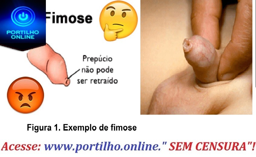 👉😠😮😱🚨😡⚖Portilho, meu filho está precisando fazer uma cirurgia de fimose eu já fui à prefeitura eles falou que eu tenho q espera…