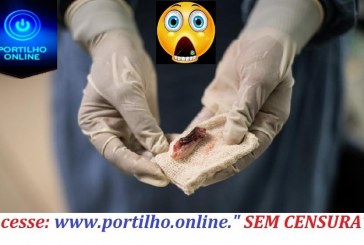 👉😱💉⚰🕯😷😮😪😱😱Que isso???? ‘Fungo preto’ Covid-19: Morre paciente com suspeita de ‘fungo preto’ no Mato Grosso do Sul