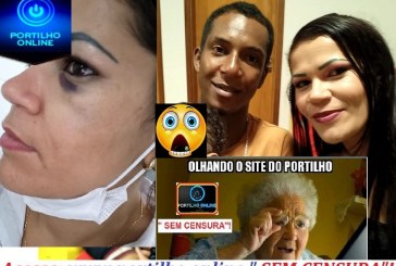 👉 O CHICOTE ESTRALOU!!! 😱😡🚑🚒👎🚓🚨⚖👊AGRESSÃO COVARDE “MARIA DA PENHA”!!! exatamente  18 dias atrás fui agredida  pelo meu companheiro Fábio Oliveira  Souza  por questionar  que não havia nada dentro de casa par nois alimentar.