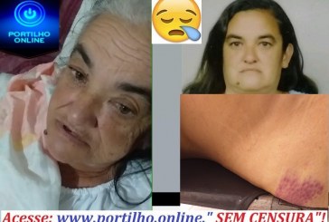 👉😳😱🚨⚰⚖🚔 OS ÁUDIOS E VÍDEO PREVENDO  DO SOFIMENTO E A MORTE DESSA SENHORA NEUZA DE 67 ANOS QUE “SUPOSTAMENTE CAIU DA CAMA’…