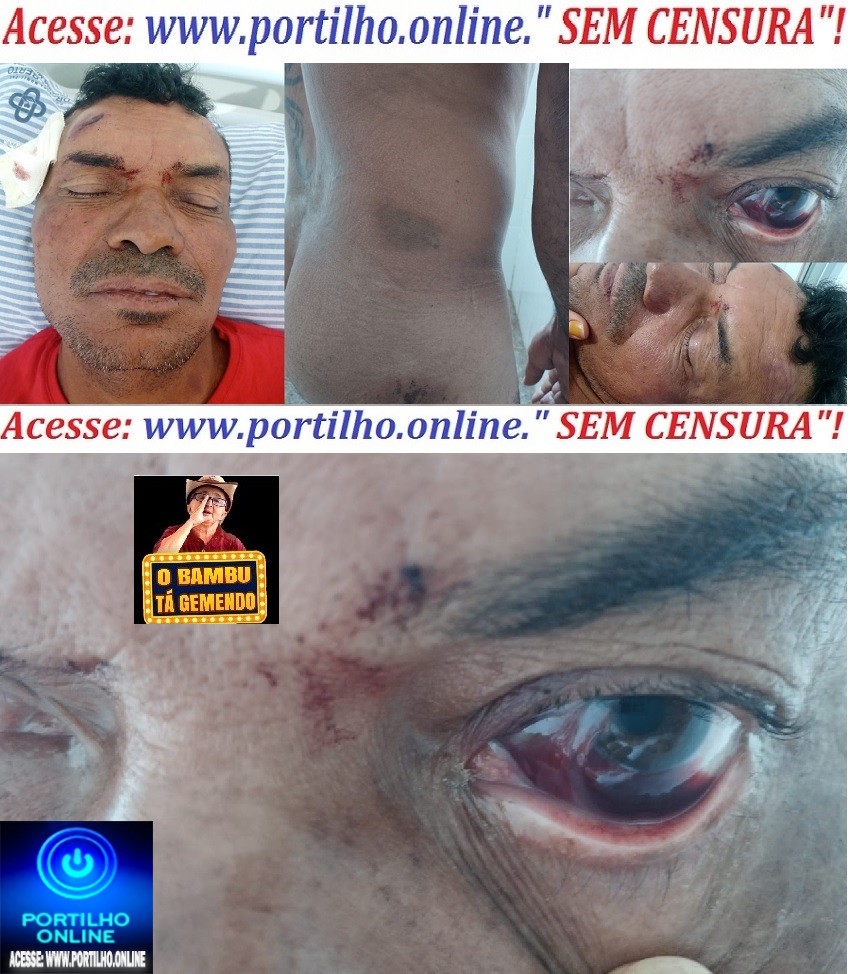    ⚖🚨👉😮💣🚓🚒🚔💥SERRA DO SALITRE!!!! O CHICOTE ESTRALOU E A CHIBATADAS ESTRALOU COM FORÇA!!! Vítima apanha até na bunda!!!!!