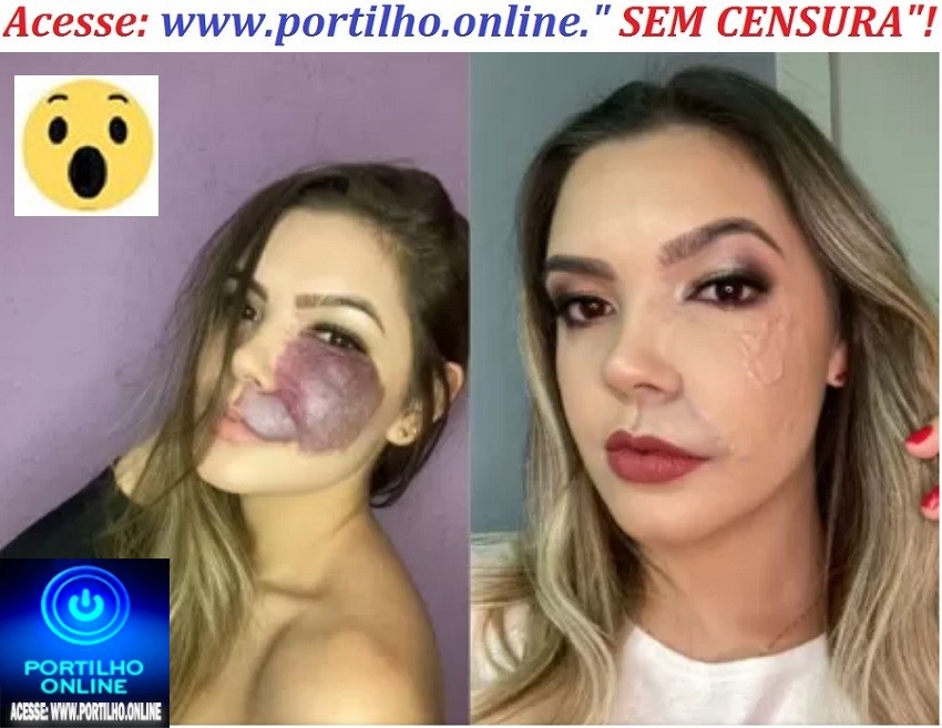 👉😳🙄👀🤔😮💉🌡💊🔬TRANSPLANTE DE FACE!!! Medo da sociedade me fez encarar um transplante de pele: ‘Sofri muito’