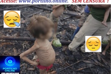 👉⚰🚑😪🚓🚔🚨🔎🚒🚑😪😪😪TRAGÉDIA HUMANITÁRIA!!! Malária, pneumonia, desnutrição, contaminação por mercúrio: Fantástico mostra a tragédia humanitária na Terra Indígena Yanomami