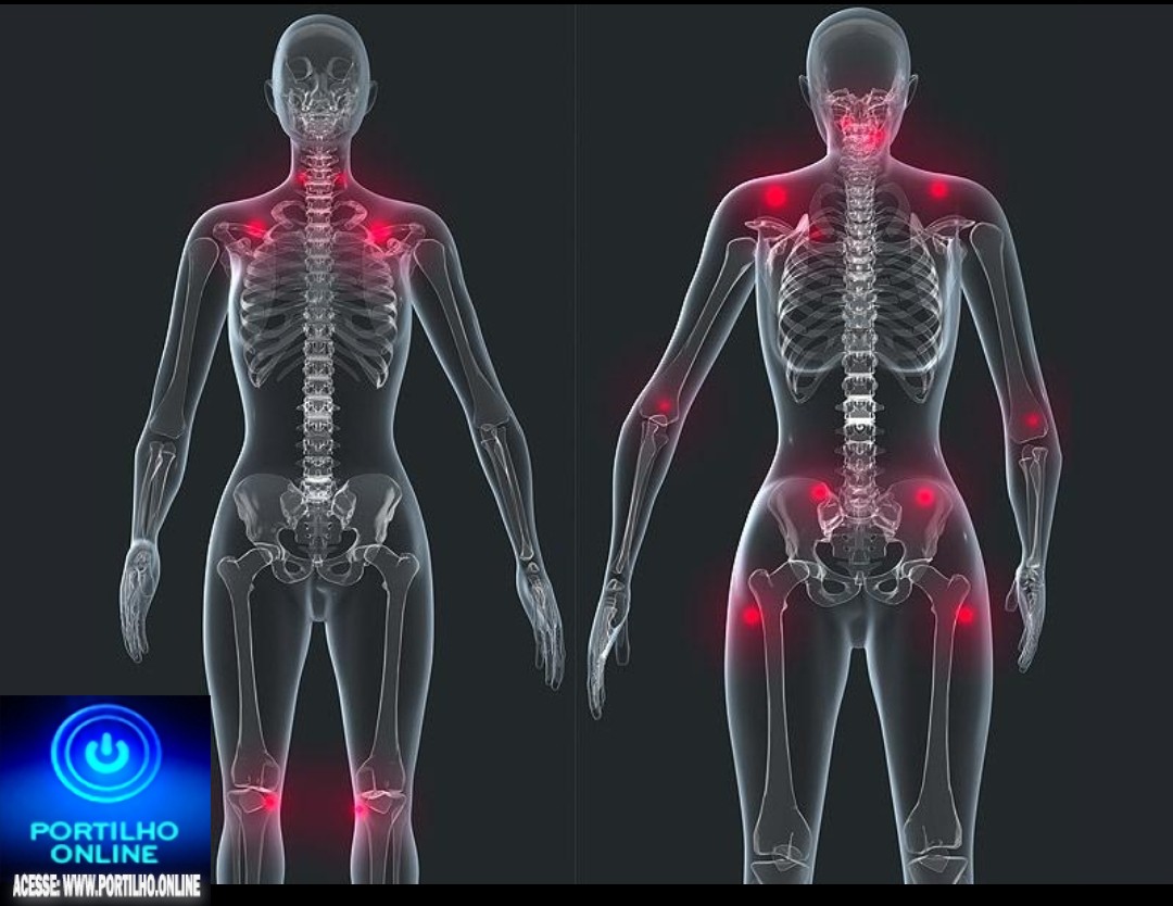 👉🏻🚐🚑🚒🩺🩻🌡🎯💉🩸Portadores de FIBROMIALGIA, têm direito à Aposentadoria?