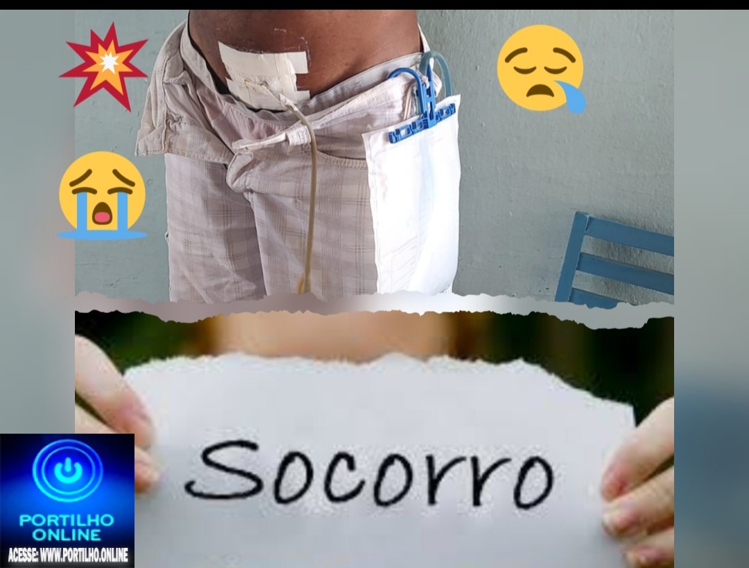 👉🏻 🫵ASSISTA AOS VÍDEOS… 🫵🏻🚨🚑🗣🫗🦽🩼🦼⚖🩸💉💊🩺🩻🔬🌡PASMEM!!! ASSISTA AOS VÍDEOS DO PACIENTE CLAMANDO  POR AJUDA. ELE ESTÁ COM UMA SONDA ESPERANDO PRA SER RETIRADA HÁ 7 MESES