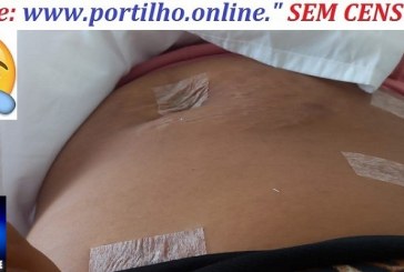 👉🍽🍴📢😪🥛Mãe pede ajuda! Portilho, Meu nome e Tatiane Barbosa Leite estou na Santa casa de passei por cirurgia pra retirada da vesícula biliar