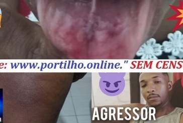 👉😱🚔🚑🚨🚒😡⚖SOCORRO!!! 😔 Oi Portilho Fui agredida às 04:20 da madrugada e venho aqui pedir socorro pelo amor de Deus