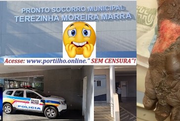 👉🚒🚑📢💉🧬💊🩺⚖️🩻🩸🚨Um paciente vítima de queimaduras gravíssimas foi socorrido no pronto-socorro, e a médica Mariana o medicou apenas com dipirona e o mandou para casa?