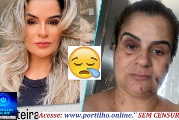 👉UM BELO ROSTO DESCONFIGURADO!!!📢💥👿🚨⚖🙄❓😡😠🤬😳Brutalidade e Covardia Contra uma Mulher! Agressões Covardes. Sabe Quem a Agridiu? Veja Aqui!