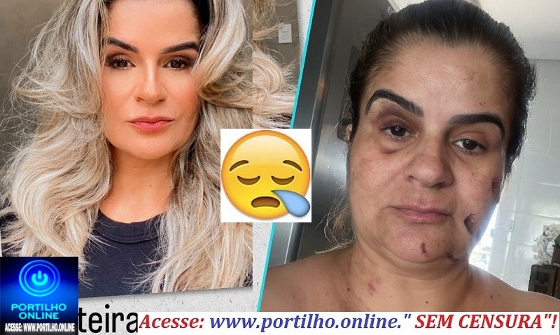 👉UM BELO ROSTO DESCONFIGURADO!!!📢💥👿🚨⚖🙄❓😡😠🤬😳Brutalidade e Covardia Contra uma Mulher! Agressões Covardes. Sabe Quem a Agridiu? Veja Aqui!