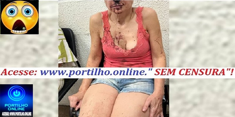 👉👊📢⚖🚨🚓🤬🚔👎Na Mira Médica tem nariz quebrado por marido advogado após briga sobre filho