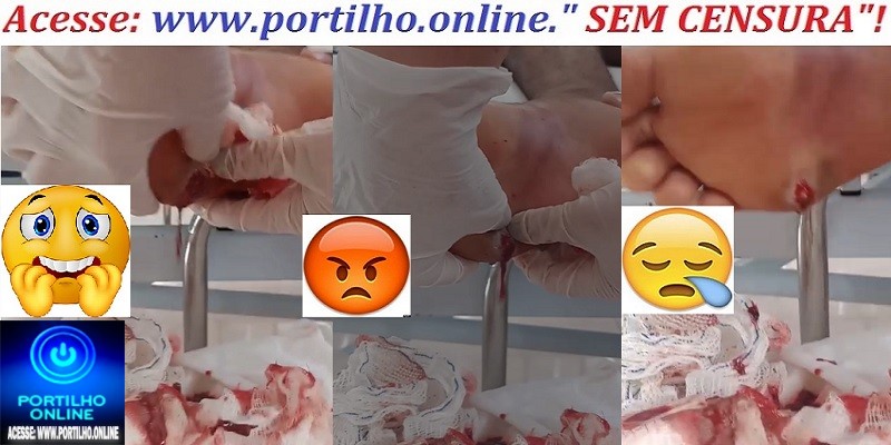 🫵🏻🫵🏻l ⚖👿🚨🩺🩻🩸💊🧬💉🚑🩼😥Portilho por favor me ajuda. Olha aí o pé  do garoto todo podre. Médica espremendo 