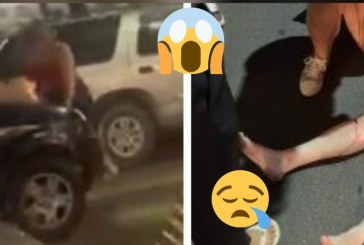 👉Mulher é atropelada🕯⚰🚨🔍❓🔎🚑🚔🚒⚖🚧🚦Isso foi uma tentativa de homicídio