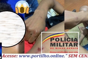 👉📢🚨👀🗣⚖🔎🕵🔍👁🤔🚒🚑🚔🚓Denúncia de agressão policial: mãe relata ataque a filho em pronto-socorro