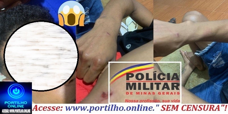 👉📢🚨👀🗣⚖🔎🕵🔍👁🤔🚒🚑🚔🚓Denúncia de agressão policial: mãe relata ataque a filho em pronto-socorro