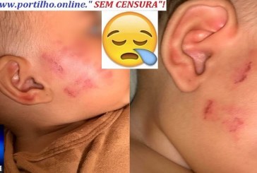 👉🤔😱👿🚨😪😥😔😭“Quatro minutos sendo mordida”, diz mãe de bebê que denunciou creche