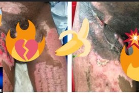 😱📢😱” Pinto 🐤 🐣 desbotado com acetona”⚖👀🗣📢👄🥀🔪✂✂🐥🐤