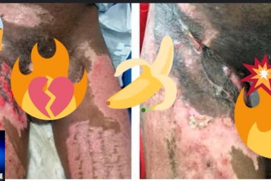 😱📢😱” Pinto 🐤 🐣 desbotado com acetona”⚖👀🗣📢👄🥀🔪✂✂🐥🐤