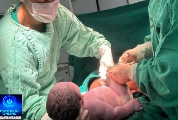 👉📢😇🙄😱😮👀Bebê gigante quebra recorde e nasce com 6,2 kg em Minas Gerais