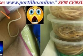 👿🚨🩺🩻🩸💊🧬💉🚑🩼😥Menino vomita vermes horas depois de ser diagnosticado com constipação