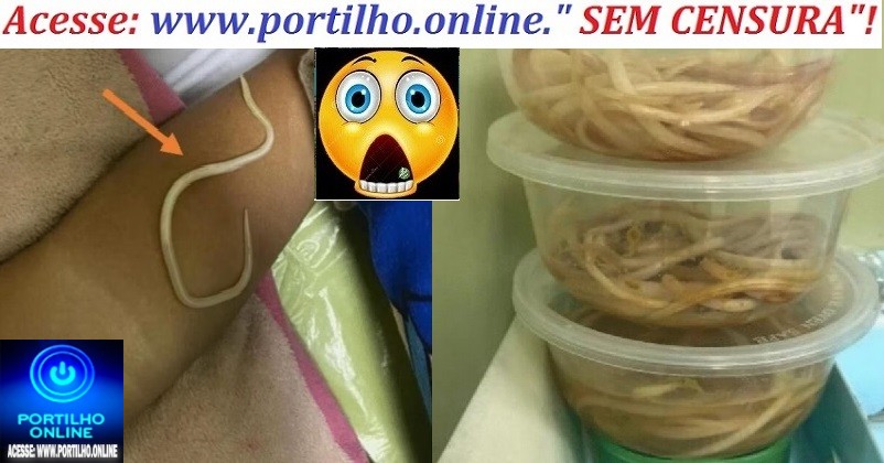 👿🚨🩺🩻🩸💊🧬💉🚑🩼😥Menino vomita vermes horas depois de ser diagnosticado com constipação