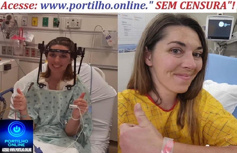 🚨🩺🩻🩸💊🧬💉🚑🩼😥“Sou uma estátua humana”, diz mulher que não consegue mexer a cabeça