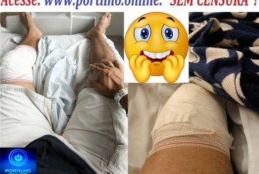 👉👏🙌🤙😰🤤😪🙌PEDIDO DE AJUDA; Portilho nunca fui de pedir ajuda não, tô precisando de uma muleta e tbm cesta basica