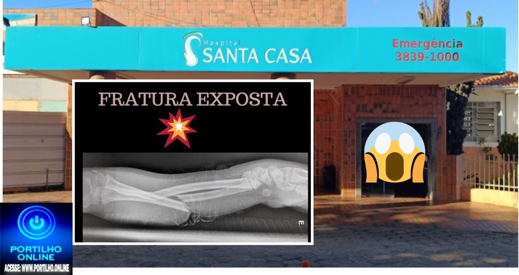 🫵🏻 SANTA CASA.⚖👿🚨🩺🩻🩸💊🧬💉🚑🩼😥Portilho…Santa Casa: “Portillho nós pacientes…”essa Santa casa já foi melhor.Portilho boa tarde… O raio X da Santa Casa está estragado alguns dias e não tem previsão