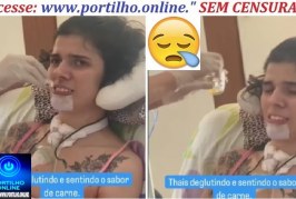 📢👉🧐🔍🕵🔎🚔🚨🚧Justiça toma atitude para garantir home care a jovem que cheirou pimenta